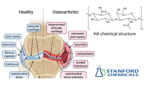 How Hyaluronic Acid Treats Joint Diseases