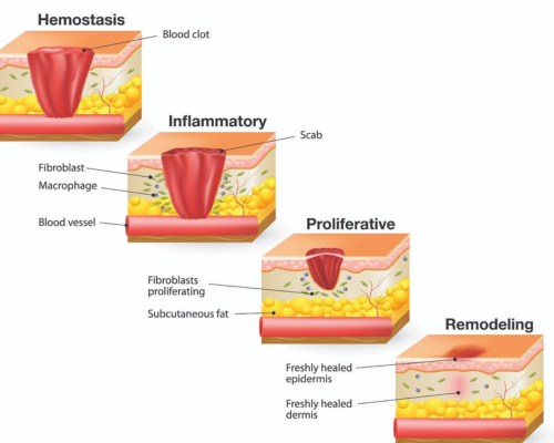 Wound Healing Process