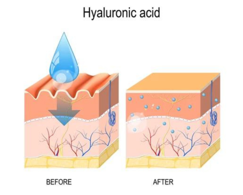 Skin Benefits of Hyaluronic Acid