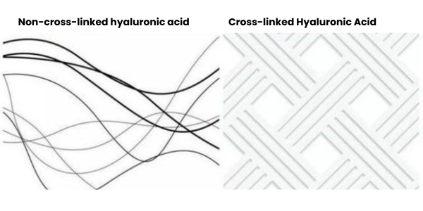 Non-cross-linked hyaluronic acid vs. cross-linked hyaluronic acid